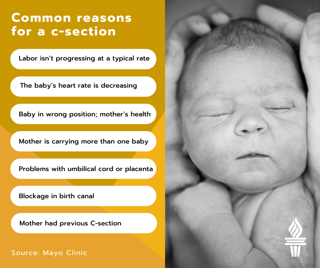 Common reasons for a C-section